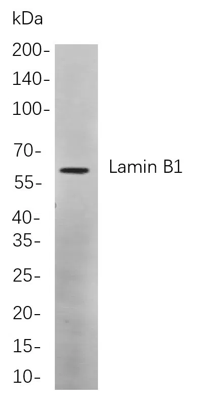 AMRe21540