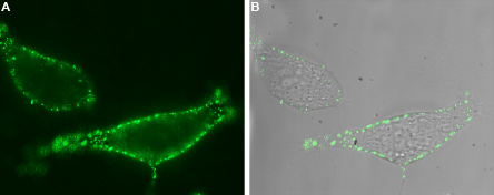 Expression of TRPV6 in human LNCaP cells