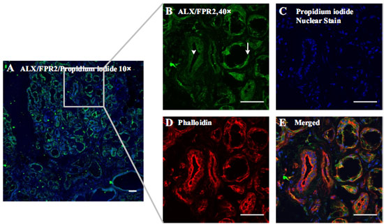 Expression of ALX/FPR2 in hMSG.