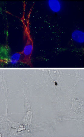 Multiplex staining of p75 NTR and mGluR1 in rat DRGs