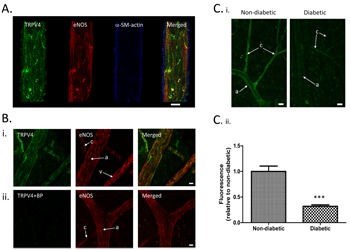 Downregulation of TRPV4 in rat retinal microvascular endothelium.
