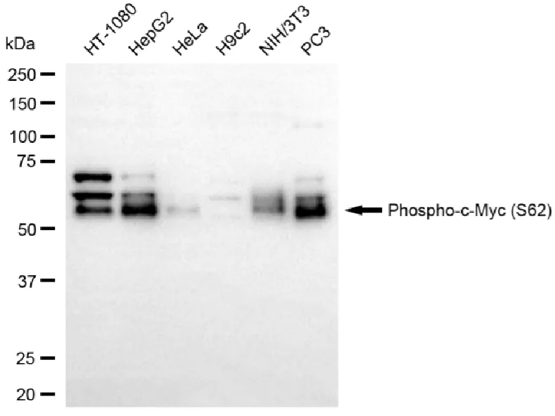 KVAb01538