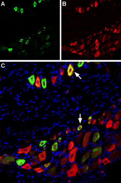 Multiplex staining of TRPV1 and Na V 1.8 in rat DRG