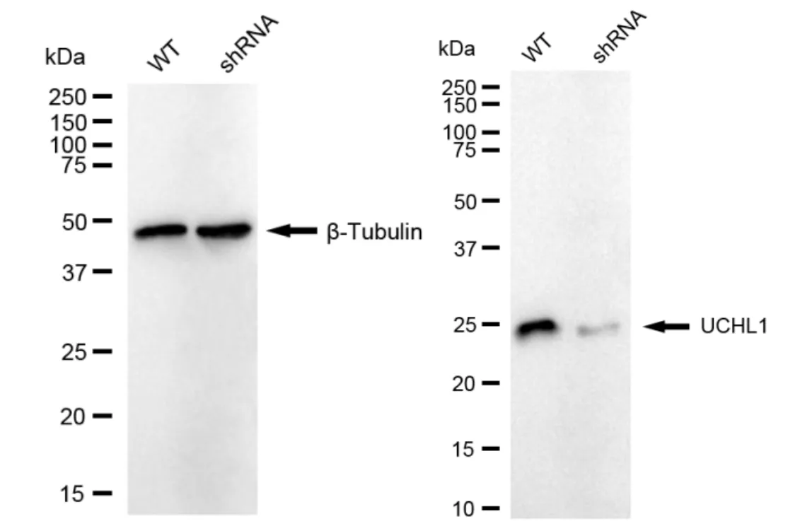 KVAb01755