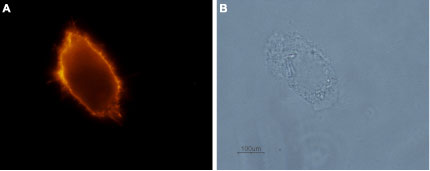 Expression of p75 NTR in p75 NTR -transfected 3T3 cells