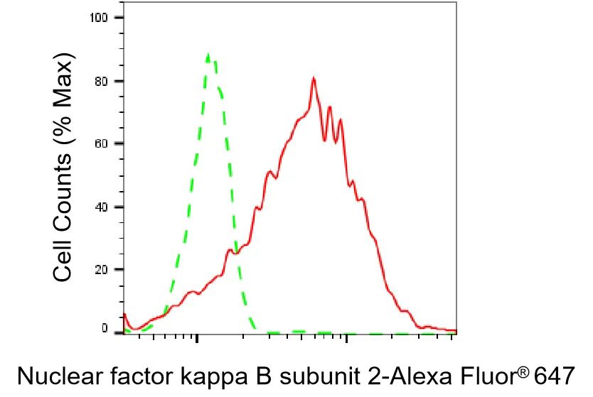 KVAb01395