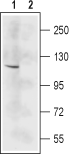 Western blot analysis of mouse brain lysate: