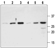 Western blot analysis of Recombinant mouse proNGF protein (#N-250), (lanes 1-3) and Recombinant human proNGF protein (#N-280), (l