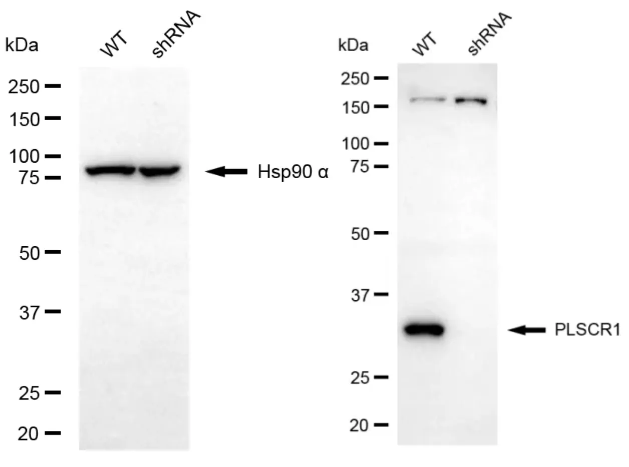 KVAb00457