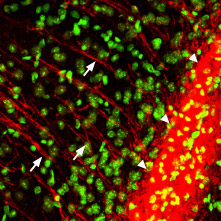 Expression of P2RY12 in mouse brain