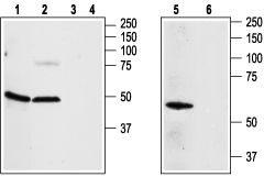 Western blot analysis of rat aortic endothelial cells (lanes 1, 3), rat brain (lanes 2, 4) and Jurkat (lanes 5, 6) lysates: