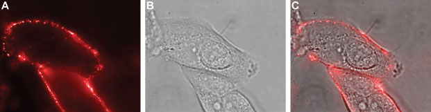 Expression of Ret in human MCF-7 breast adenocarcinoma cells