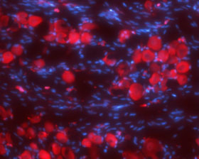 Expression of Synaptophysin in rat DRG
