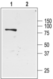 Western blot analysis of rat kidney membranes: