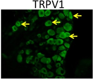 Expression of TRPV1 in mouse DRGs