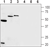 Western blot analysis of rat pancreas membrane (lanes 1 and 4), rat hippocampus (lanes 2 and 5) and mouse pancreatic cancer cell line (MS1) (lanes 3 and 6):