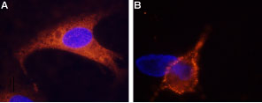 Expression of TRPM8 in rat DRG cells