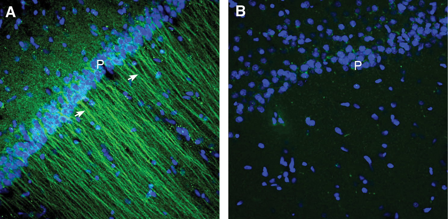 Expression of CCR2 in rat hippocampus.
