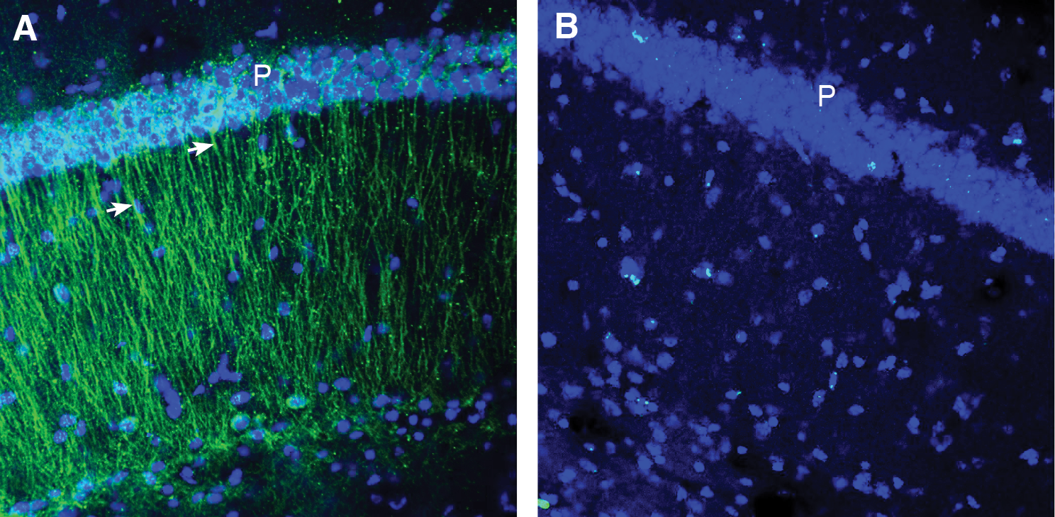 Expression of CCR2 in mouse hippocampus.