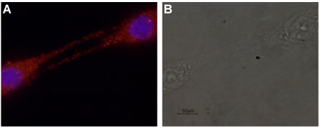 Expression of GDNF in rat C6 glioma cells