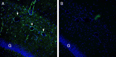 Expression of Gamma-Synuclein in rat hippocampus