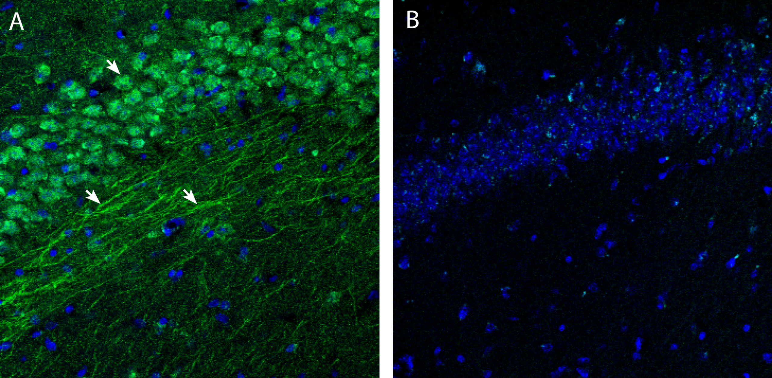 S1PR3 in mouse hippocampal CA1 region