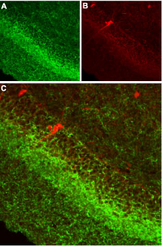 Expression of CB1 receptor in rat hippocampus