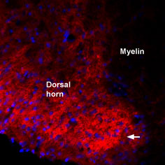 Expression of proBDNF in rat spinal cord