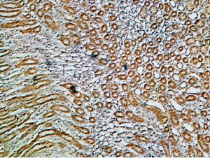 Expression of Na + /K + ATPase α1 (ATP1A1) in rat kidney
