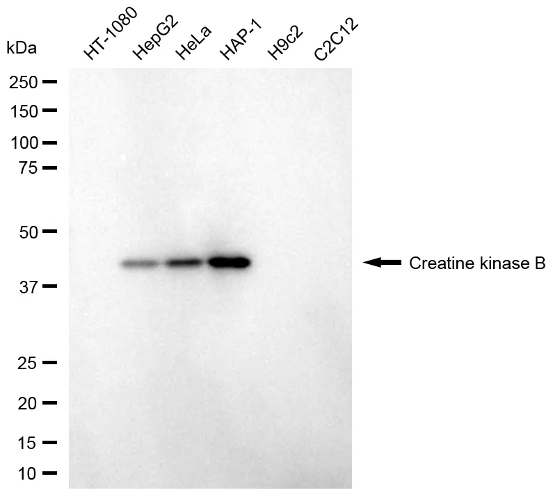 KVAb00612