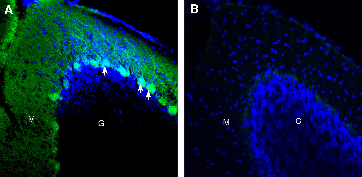 Expression of CD38 in mouse cerebellum.
