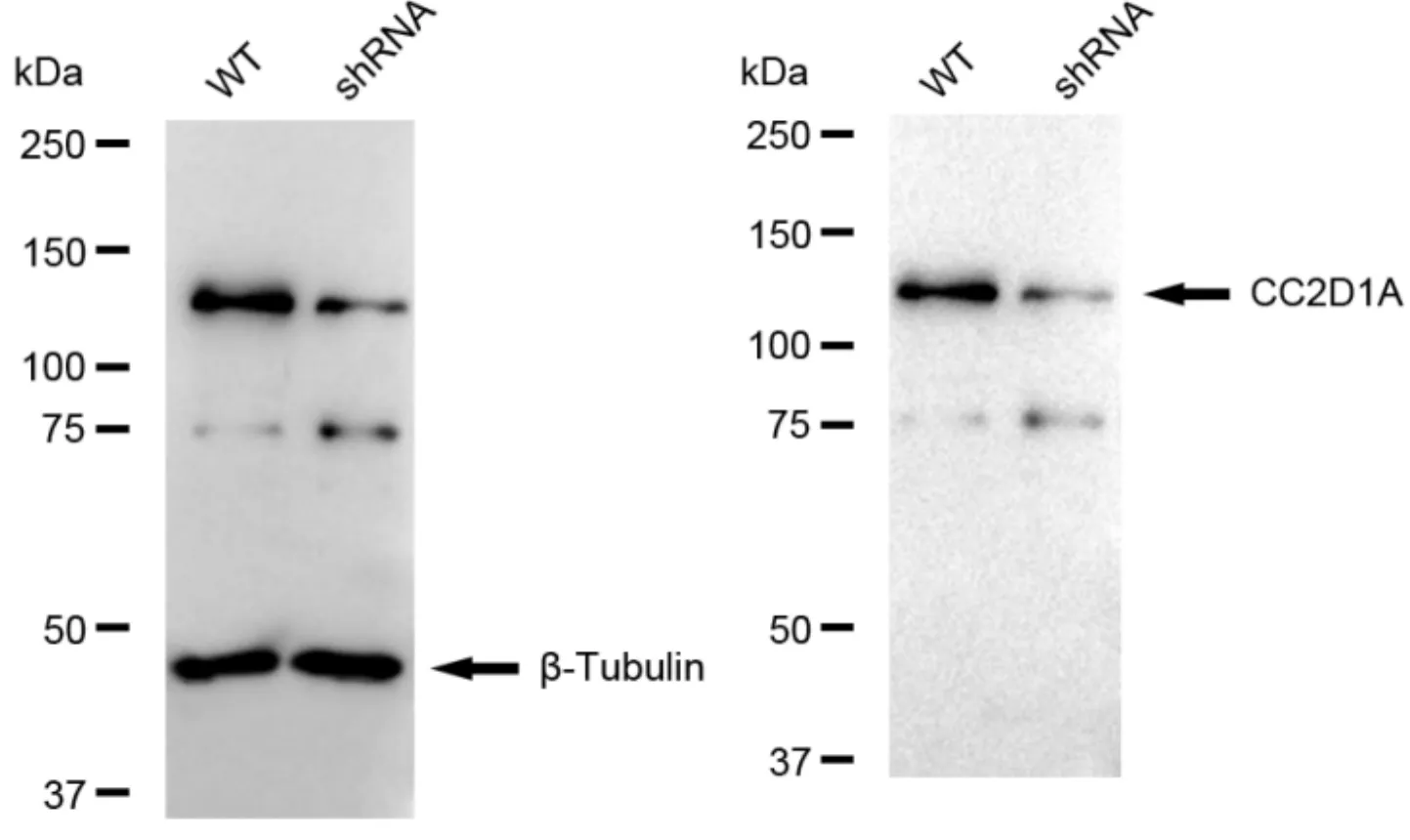 KVAb01651