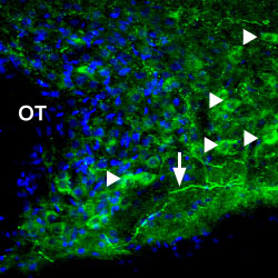 Expression of P2X1 Receptor in rat hypothalamus
