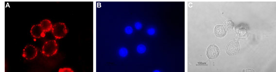 Expression of serotonin transporter in rat PC12 cells