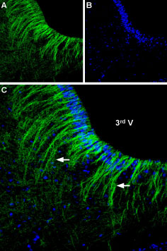 Expression of α 2A -Adrenoreceptor in rat hypothalamus