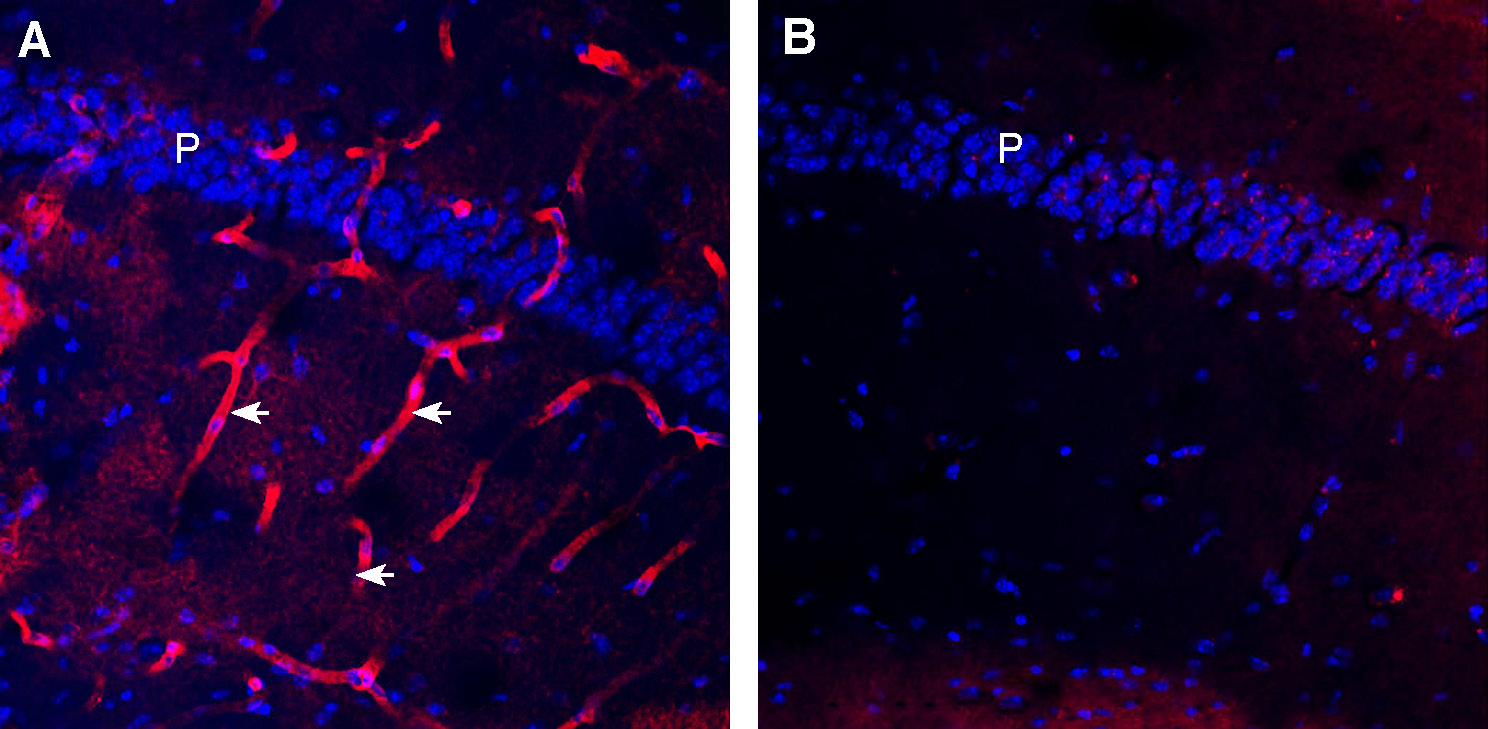 Expression of Aquaporin 4 in mouse hippocampus.