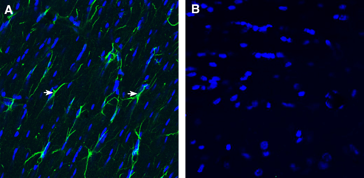 Expression of CD9 in rat fornix.