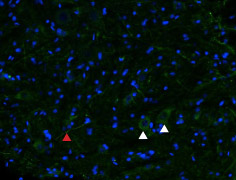 Expression of µ -opioid receptor (MOR-1) in rat spinal cord