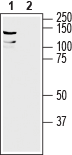 Western blot analysis of mouse brain lysate: