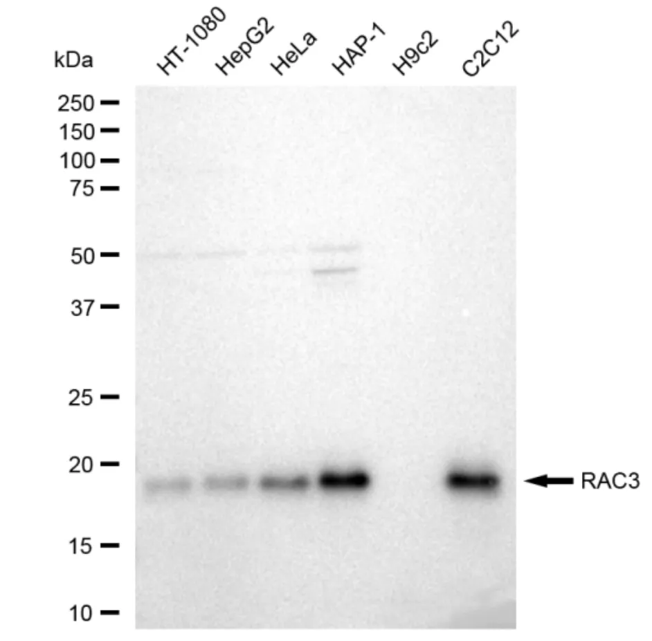 KVAb01747