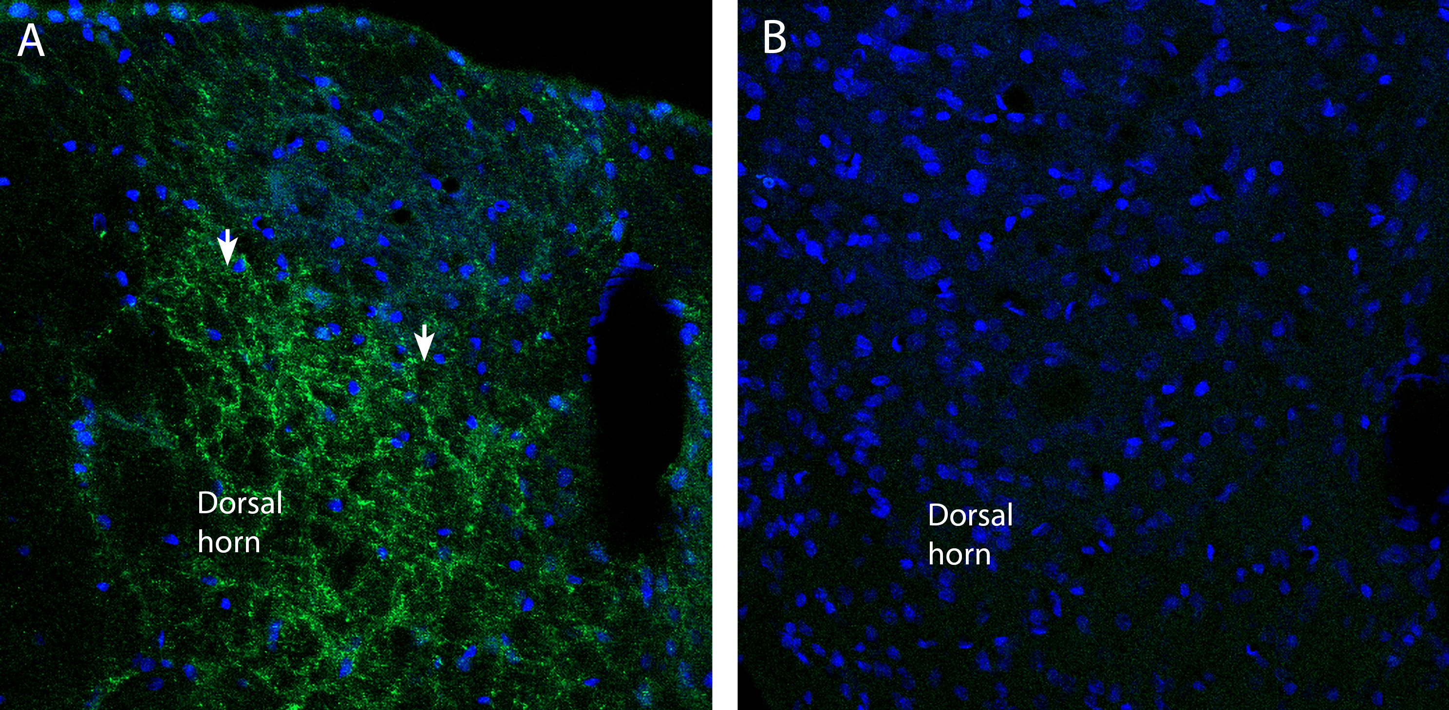 Na V 1.7 in the rat spinal cord