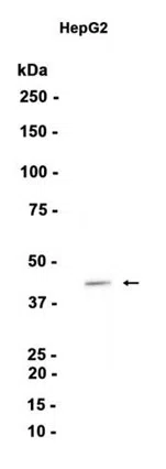 AMRe87014