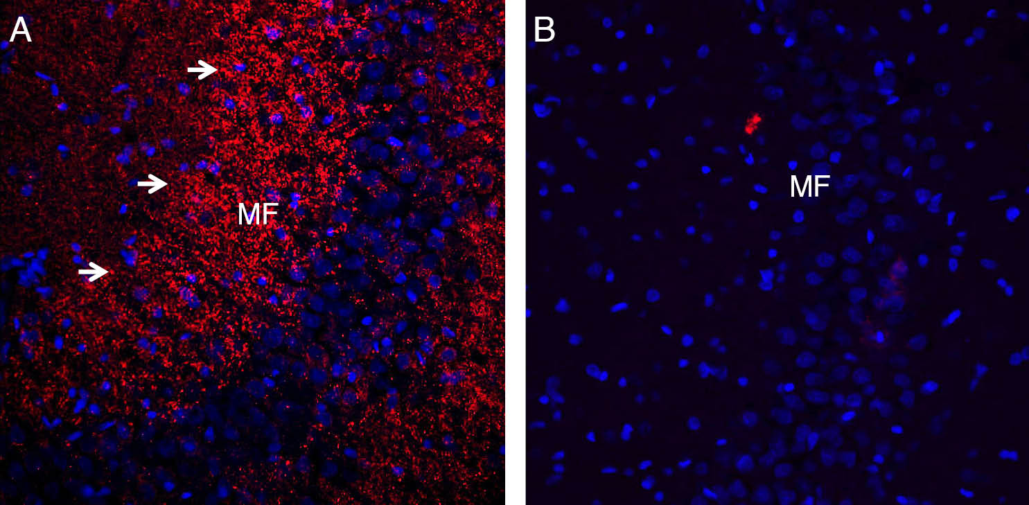 Expression of Synaptophysin in rat hippocampus.