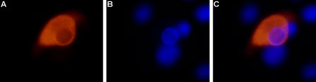 Expression of TRPV1 in rat DRG primary culture