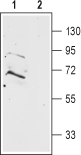 Western blot analysis of rat brain membranes:
