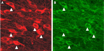 Expression of K Ca 2.3 (SK3) in mouse dopaminergic neurons