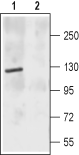 Western blot analysis of rat brain membrane: