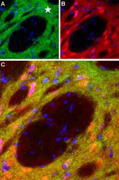 Expression of DRD1 in rat striatum