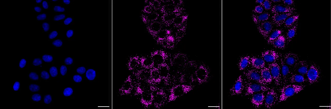 KVAb00273