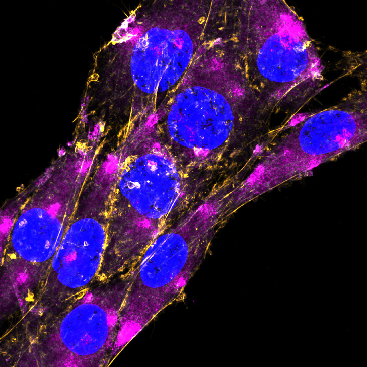 Expression of GFAP in rat C6 glioma cells